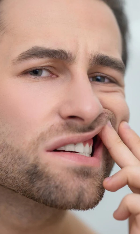 Man Holding His Gums Has Gingivitis