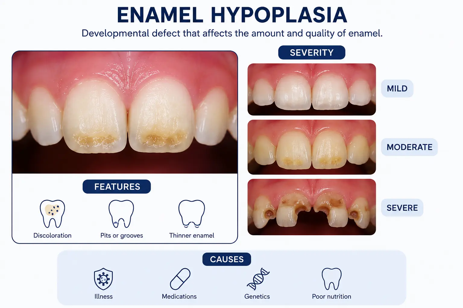Enamel Hypoplasia Infogram 2